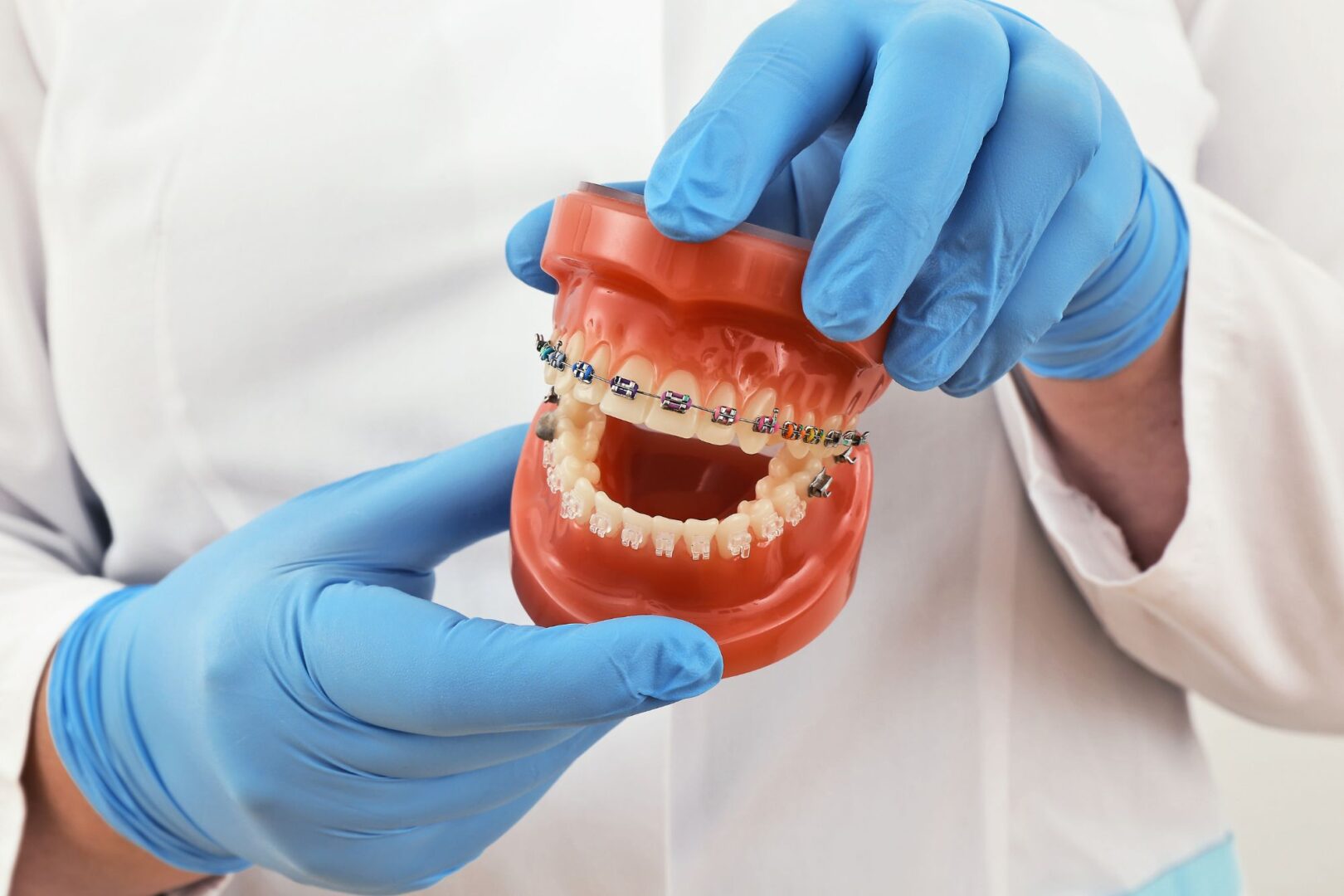Chacon Orthodontics - Custom Braces