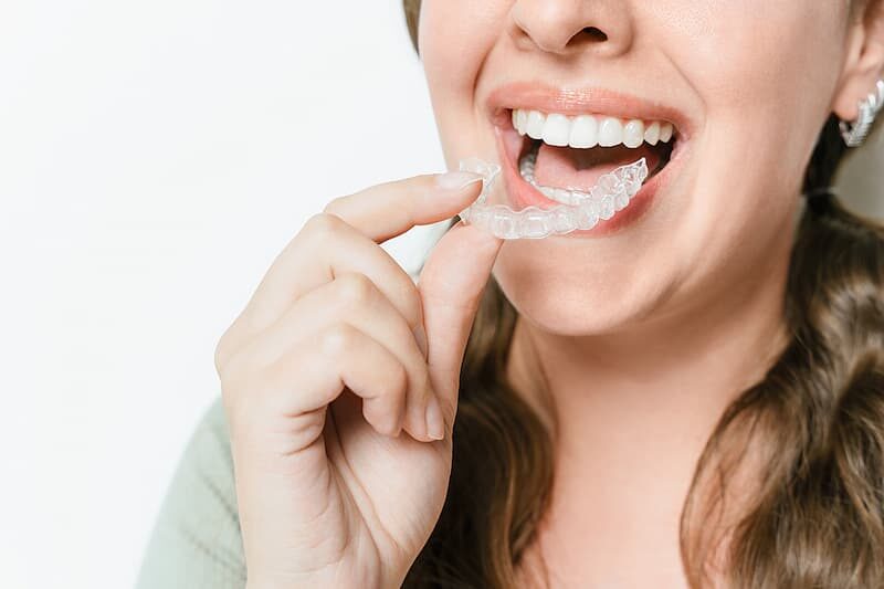 Clear Aligners Near Me