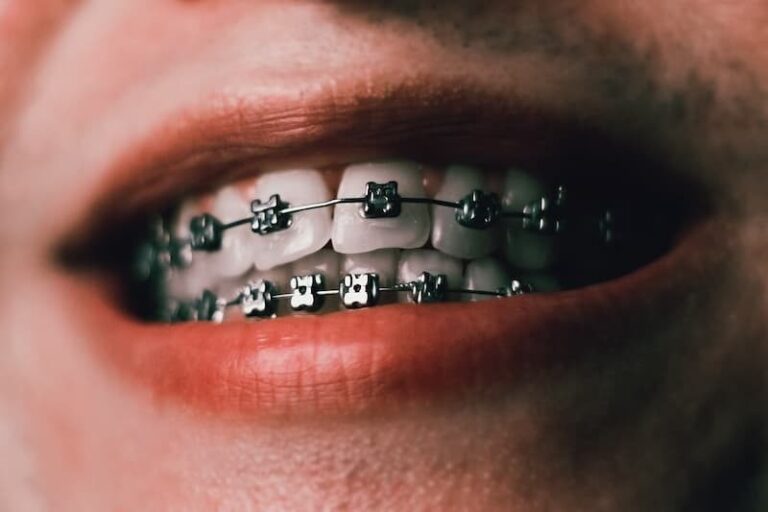 orthodontist