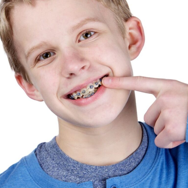 Early orthodontic treatment