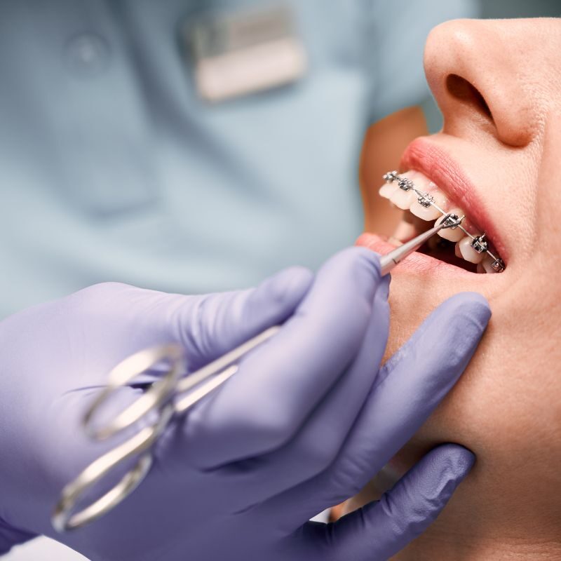 Orthodontist Near You