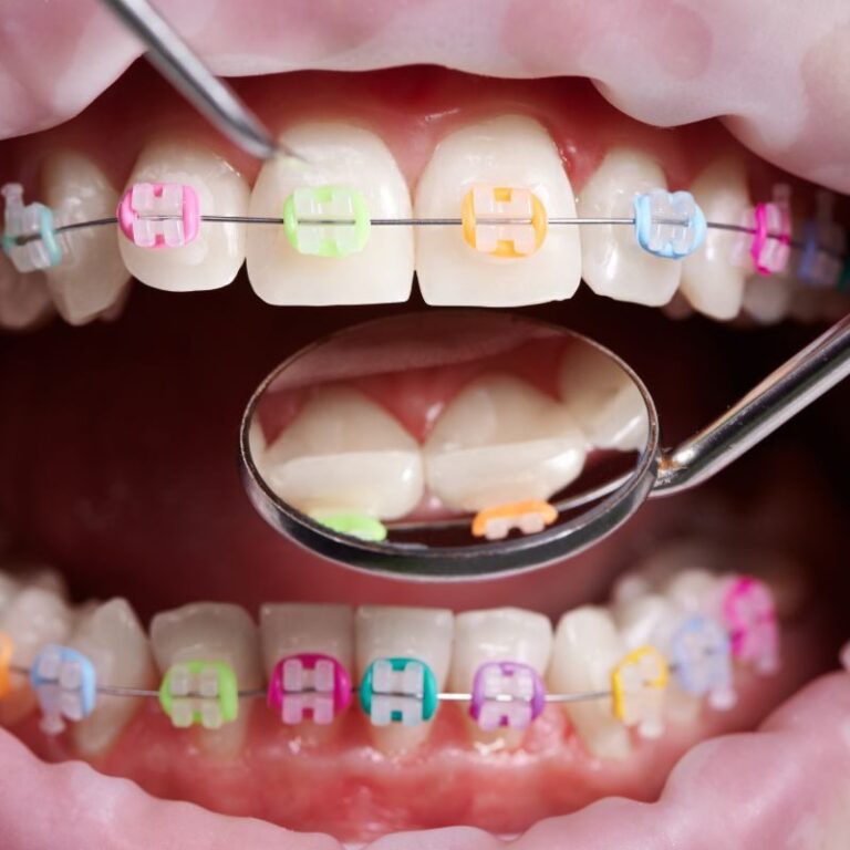 local westchase orthodontist