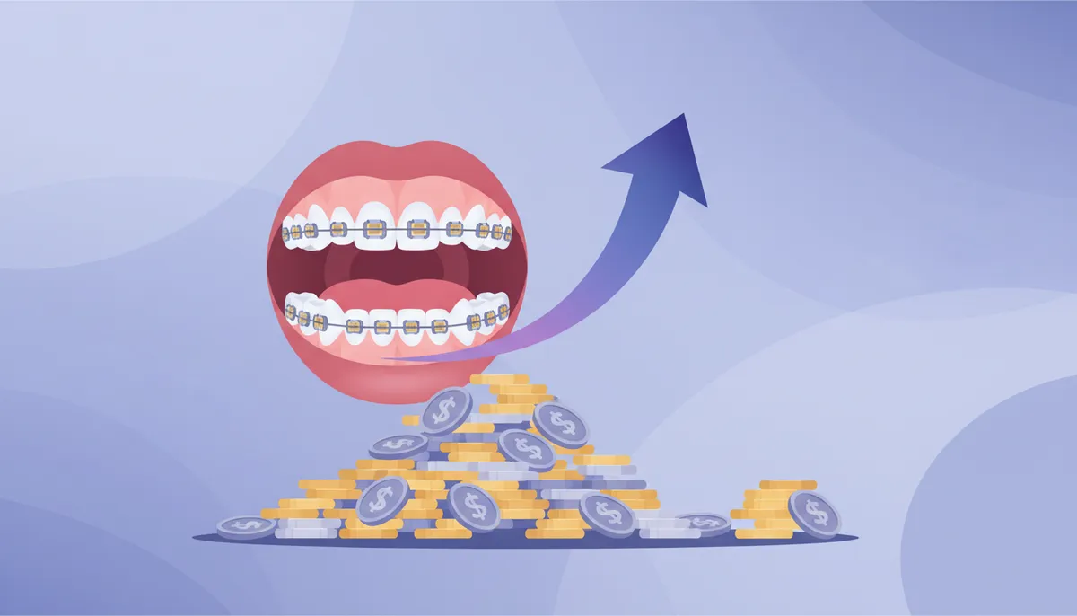 braces cost